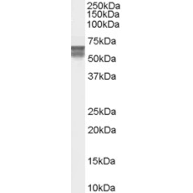 Western Blot - Anti-CACNB4 Antibody (A83440) - Antibodies.com