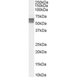 Western Blot - Anti-CACNB4 Antibody (A83440) - Antibodies.com