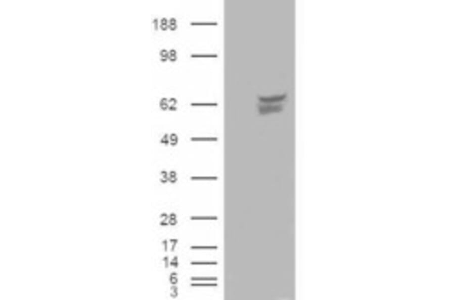 Western Blot - Anti-CACNB4 Antibody (A83440) - Antibodies.com