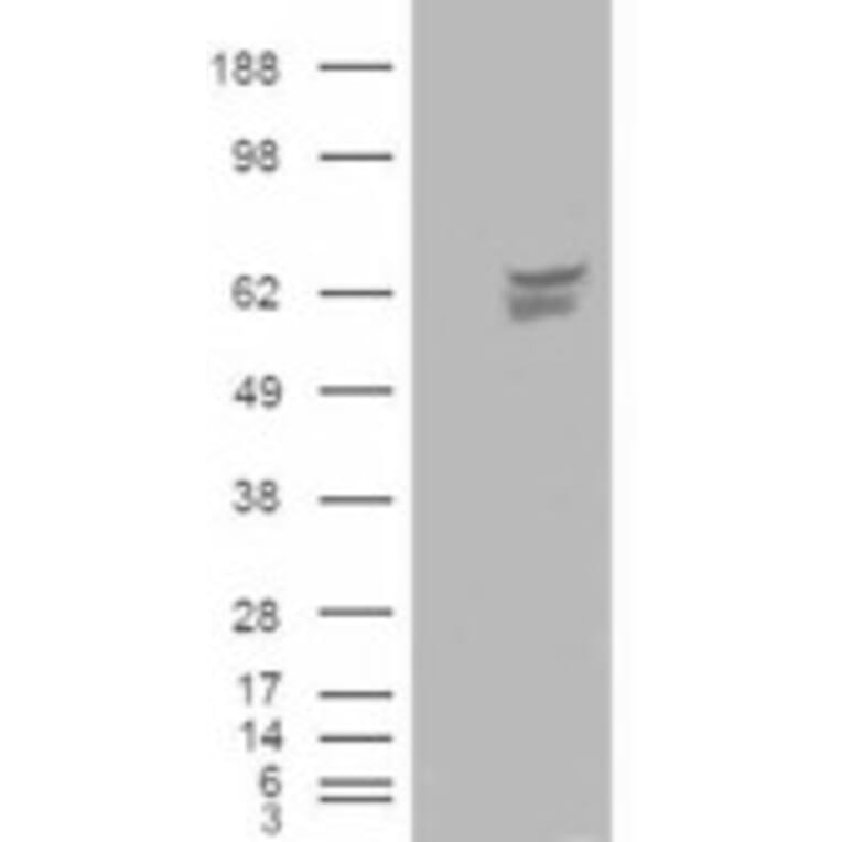 Western Blot - Anti-CACNB4 Antibody (A83440) - Antibodies.com