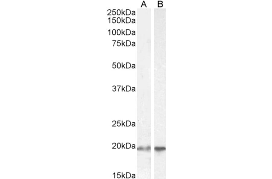 Western Blot - Anti-UBE2C Antibody (A83441) - Antibodies.com