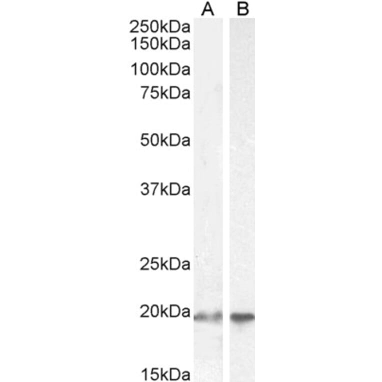 Western Blot - Anti-UBE2C Antibody (A83441) - Antibodies.com