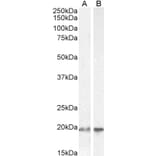 Western Blot - Anti-UBE2C Antibody (A83441) - Antibodies.com