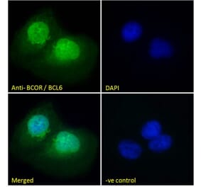 Immunofluorescence - Anti-BCOR Antibody (A83442) - Antibodies.com