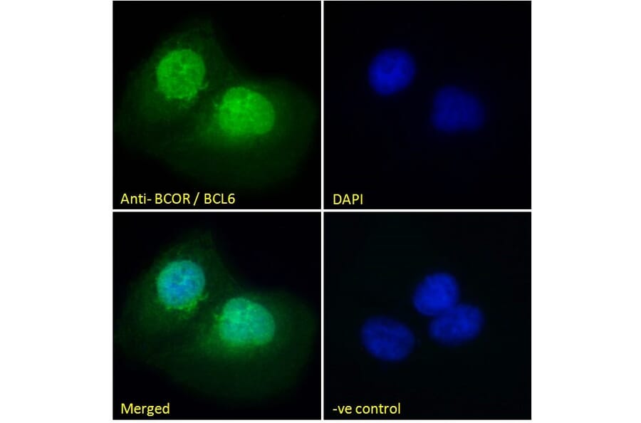 Immunofluorescence - Anti-BCOR Antibody (A83442) - Antibodies.com