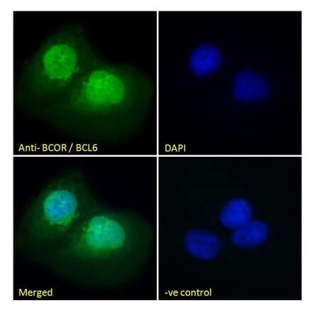 Immunofluorescence - Anti-BCOR Antibody (A83442) - Antibodies.com