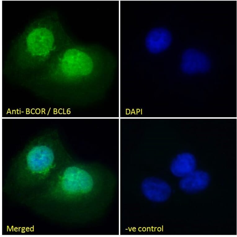 Immunofluorescence - Anti-BCOR Antibody (A83442) - Antibodies.com