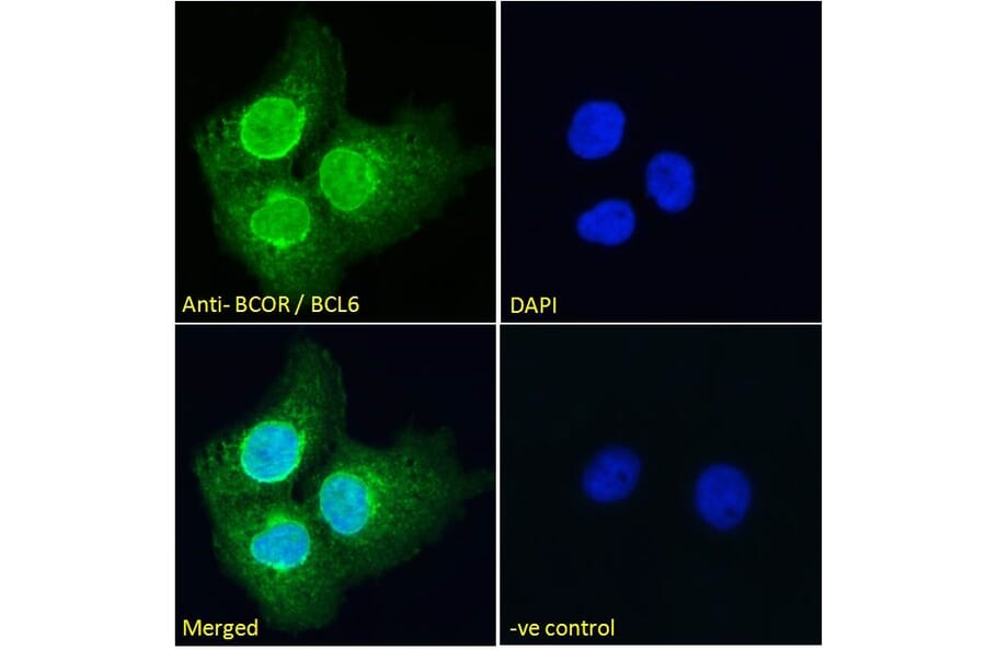 Immunofluorescence - Anti-BCOR Antibody (A83442) - Antibodies.com