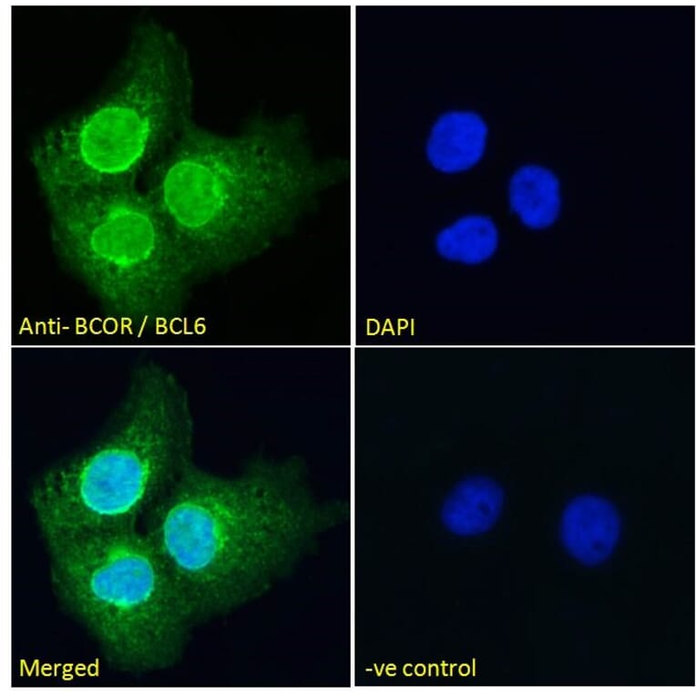 Immunofluorescence - Anti-BCOR Antibody (A83442) - Antibodies.com