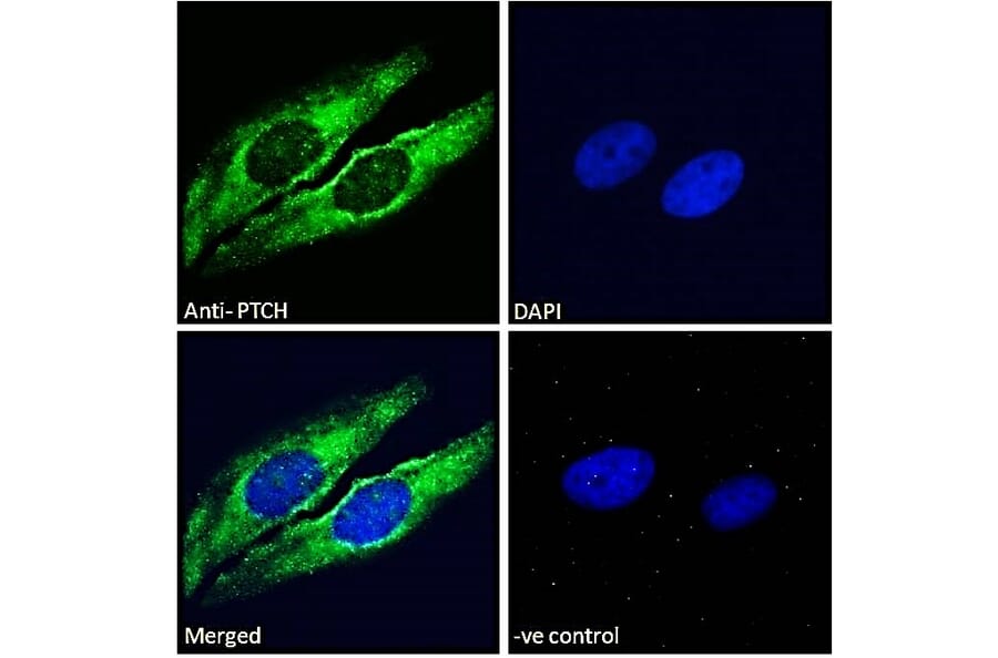 Immunofluorescence - Anti-Patched/PTCH1 Antibody (A83443) - Antibodies.com