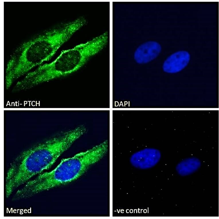 Immunofluorescence - Anti-Patched/PTCH1 Antibody (A83443) - Antibodies.com