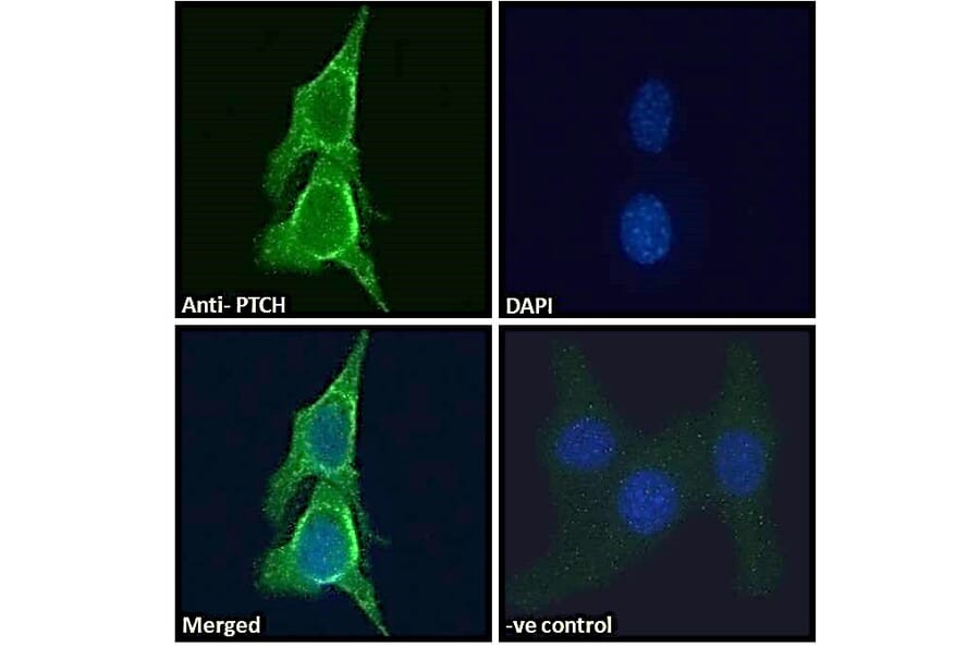 Immunofluorescence - Anti-Patched/PTCH1 Antibody (A83443) - Antibodies.com