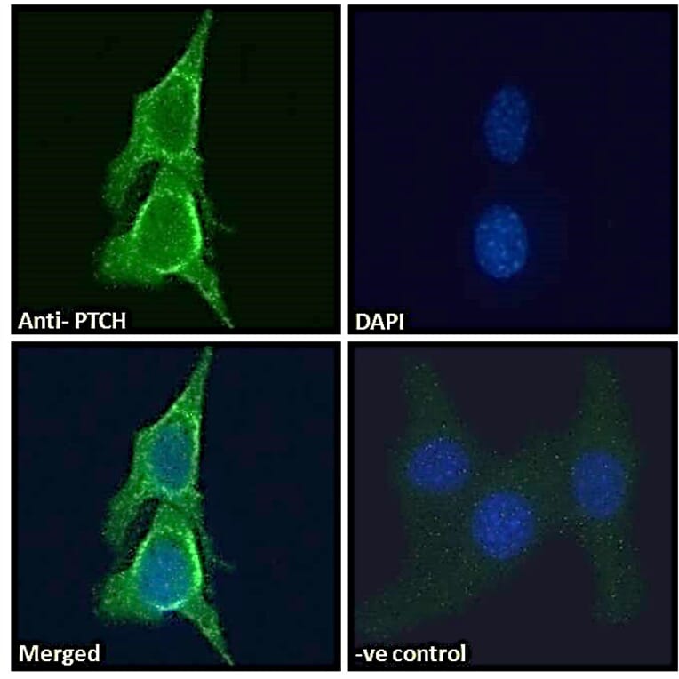 Immunofluorescence - Anti-Patched/PTCH1 Antibody (A83443) - Antibodies.com