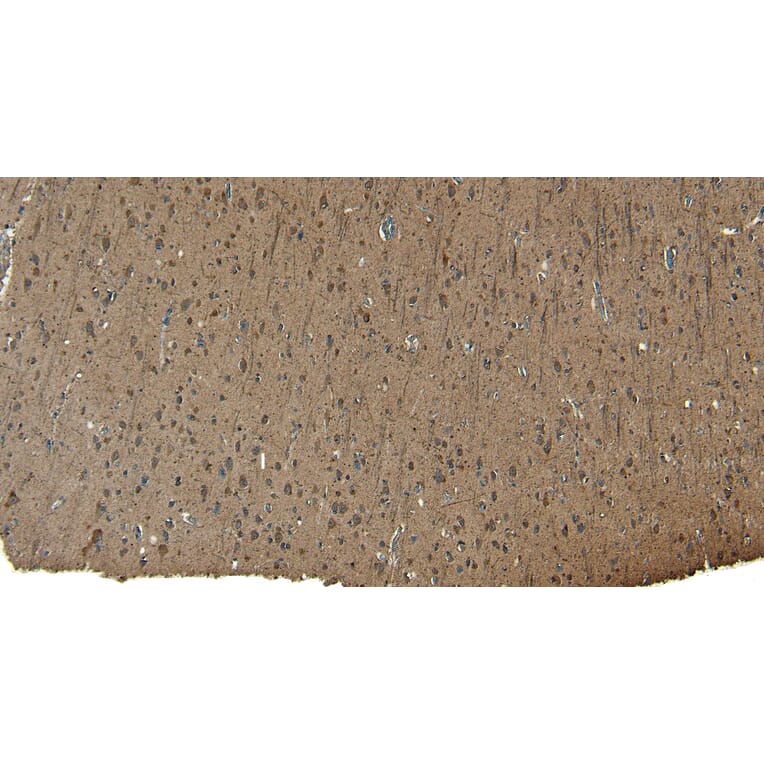 Immunohistochemistry - Anti-Patched/PTCH1 Antibody (A83443) - Antibodies.com