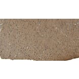 Immunohistochemistry - Anti-Patched/PTCH1 Antibody (A83443) - Antibodies.com