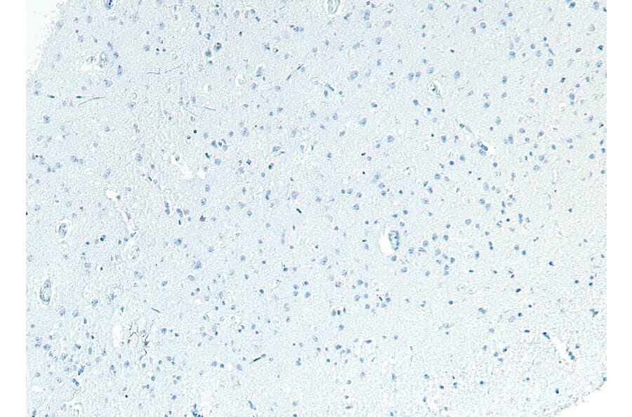 Immunohistochemistry - Anti-Patched/PTCH1 Antibody (A83443) - Antibodies.com