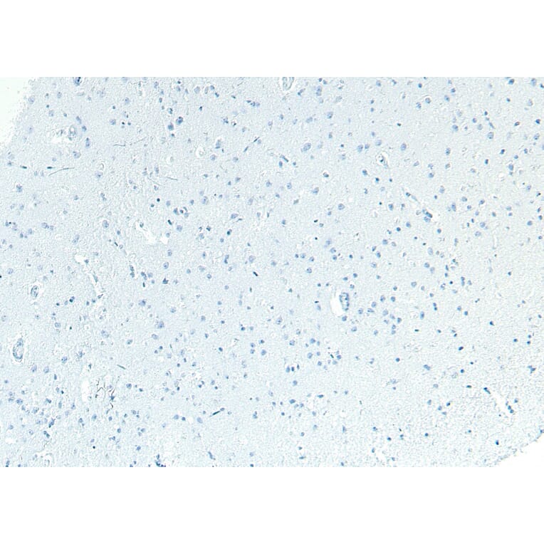 Immunohistochemistry - Anti-Patched/PTCH1 Antibody (A83443) - Antibodies.com