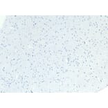Immunohistochemistry - Anti-Patched/PTCH1 Antibody (A83443) - Antibodies.com
