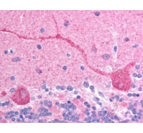 Immunohistochemistry - Anti-CHFR Antibody (A83444) - Antibodies.com