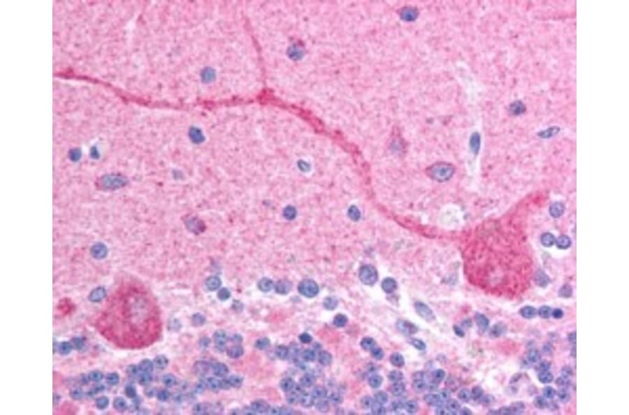 Immunohistochemistry - Anti-CHFR Antibody (A83444) - Antibodies.com