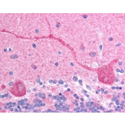 Immunohistochemistry - Anti-CHFR Antibody (A83444) - Antibodies.com