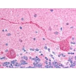 Immunohistochemistry - Anti-CHFR Antibody (A83444) - Antibodies.com