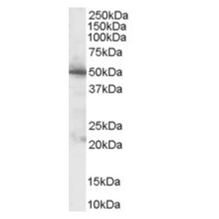 Western Blot - Anti-PDHX Antibody (A83445) - Antibodies.com