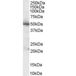 Western Blot - Anti-PDHX Antibody (A83445) - Antibodies.com