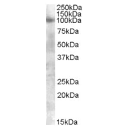 Western Blot - Anti-FGFR2 Antibody (A83447) - Antibodies.com