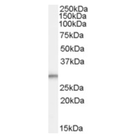 Western Blot - Anti-TPD52L2 Antibody (A83448) - Antibodies.com