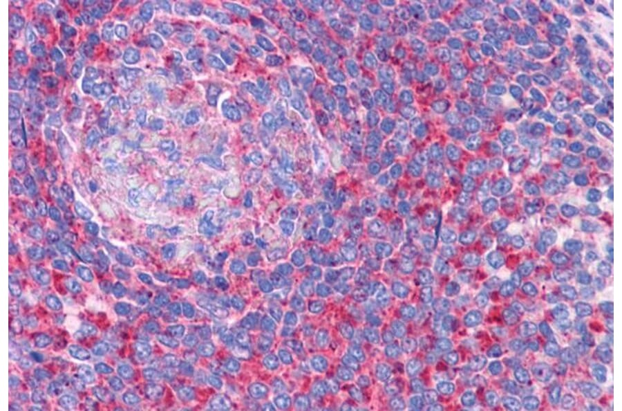 Immunohistochemistry - Anti-TPD52L2 Antibody (A83448) - Antibodies.com