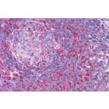 Immunohistochemistry - Anti-TPD52L2 Antibody (A83448) - Antibodies.com