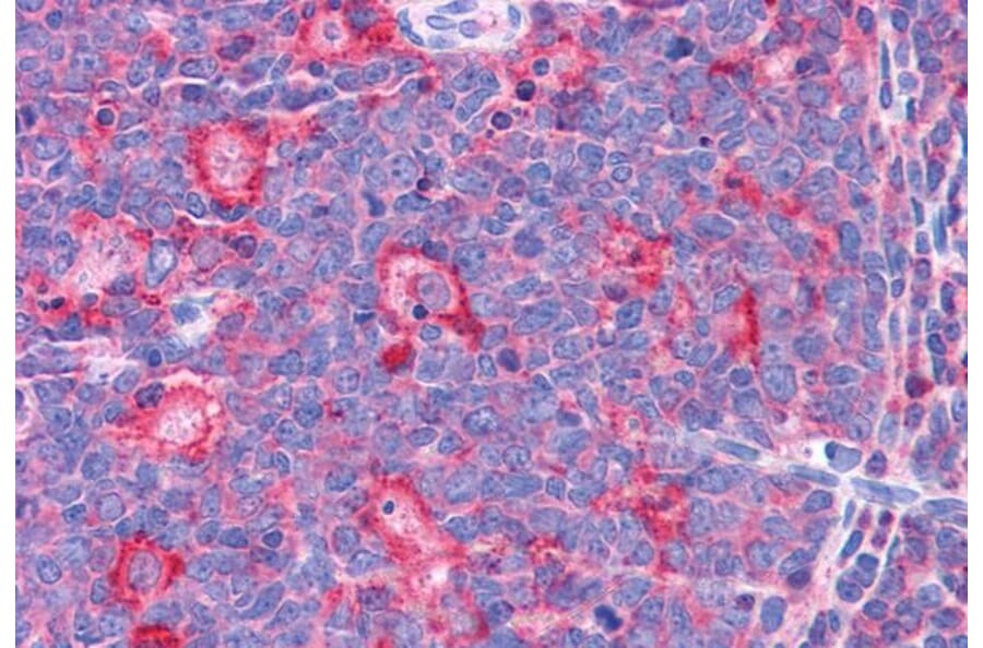 Immunohistochemistry - Anti-TPD52L2 Antibody (A83448) - Antibodies.com