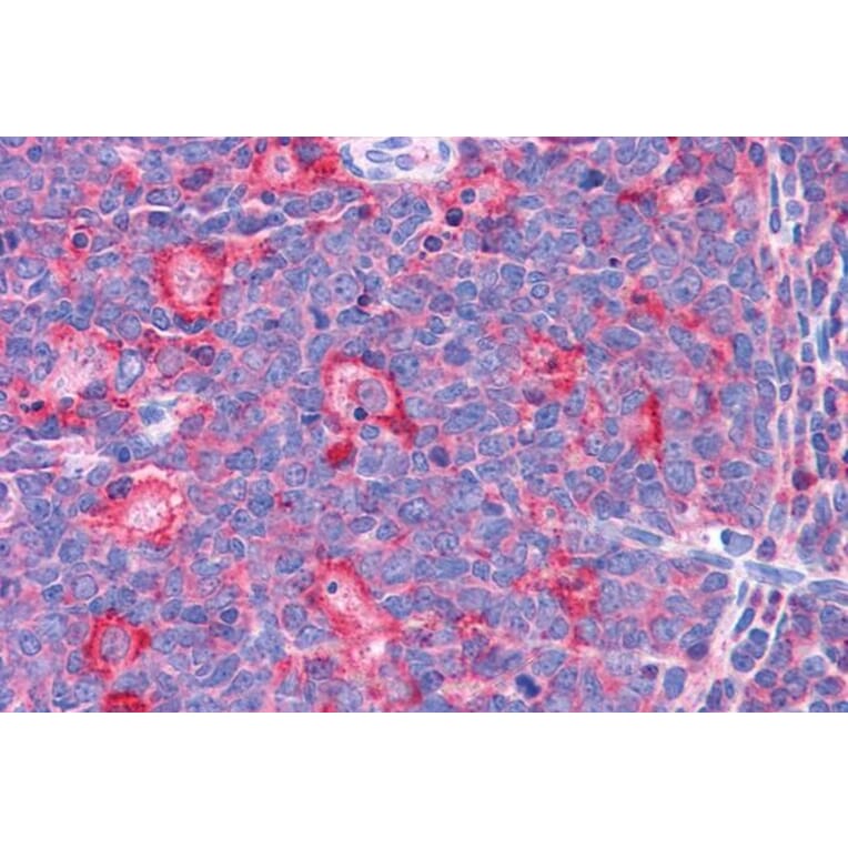 Immunohistochemistry - Anti-TPD52L2 Antibody (A83448) - Antibodies.com