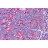 Immunohistochemistry - Anti-TPD52L2 Antibody (A83448) - Antibodies.com