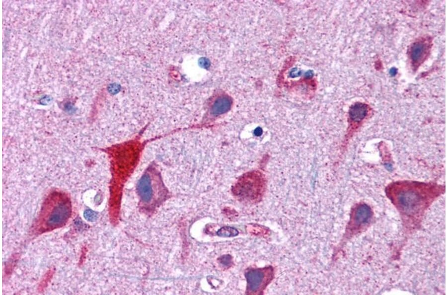 Immunohistochemistry - Anti-TPD52L2 Antibody (A83448) - Antibodies.com