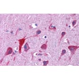Immunohistochemistry - Anti-TPD52L2 Antibody (A83448) - Antibodies.com