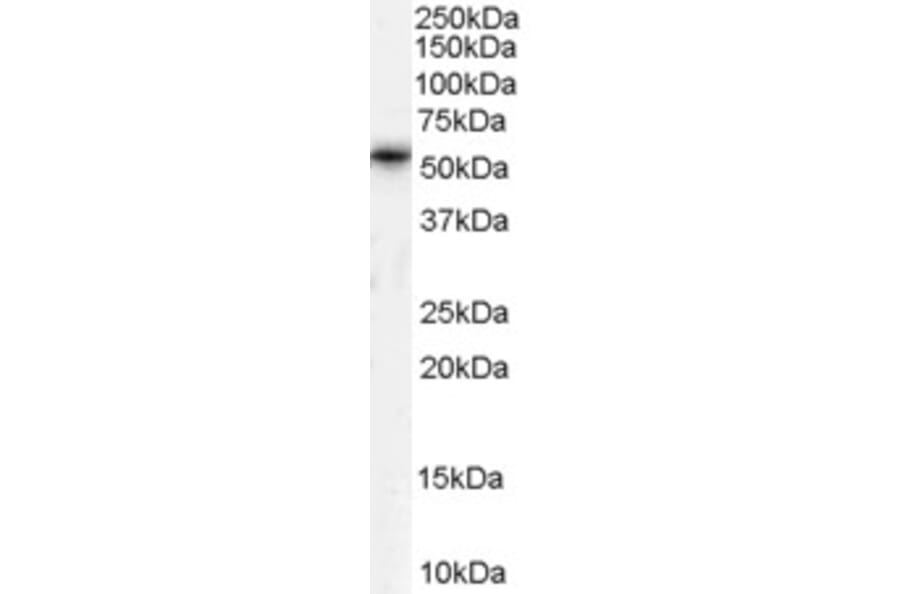 Western Blot - Anti-TPTE Antibody (A83449) - Antibodies.com