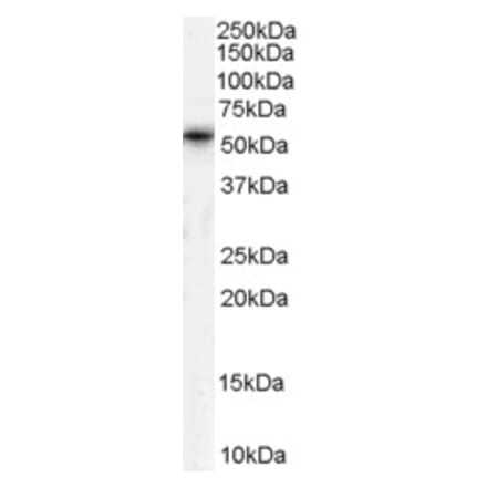 Western Blot - Anti-TPTE Antibody (A83449) - Antibodies.com