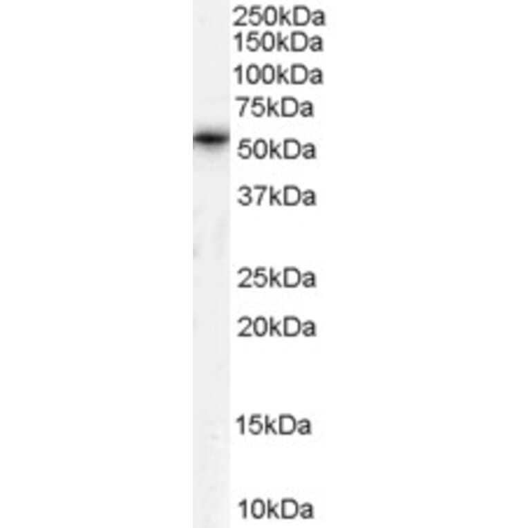 Western Blot - Anti-TPTE Antibody (A83449) - Antibodies.com