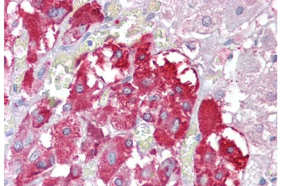 Immunohistochemistry - Anti-TPTE Antibody (A83449) - Antibodies.com