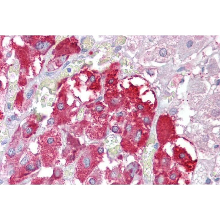 Immunohistochemistry - Anti-TPTE Antibody (A83449) - Antibodies.com