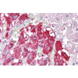 Immunohistochemistry - Anti-TPTE Antibody (A83449) - Antibodies.com