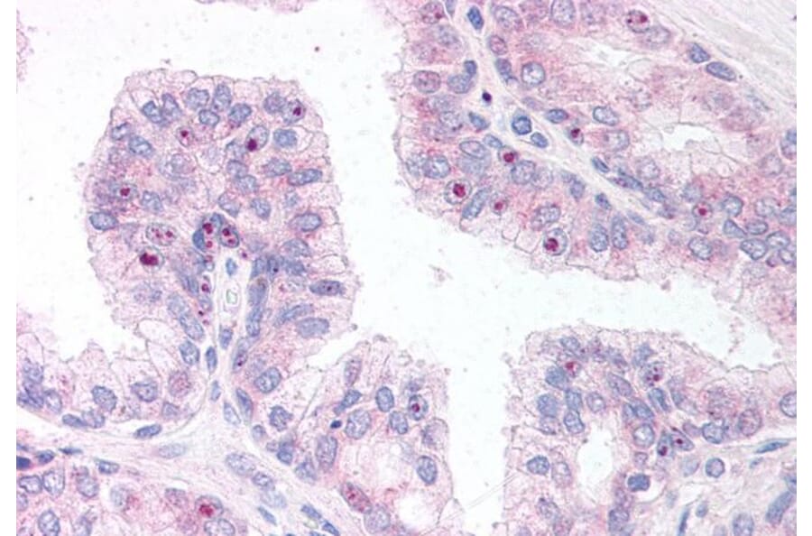 Immunohistochemistry - Anti-ERG Antibody (A83450) - Antibodies.com