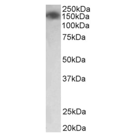 Western Blot - Anti-MYLK Antibody (A83451) - Antibodies.com
