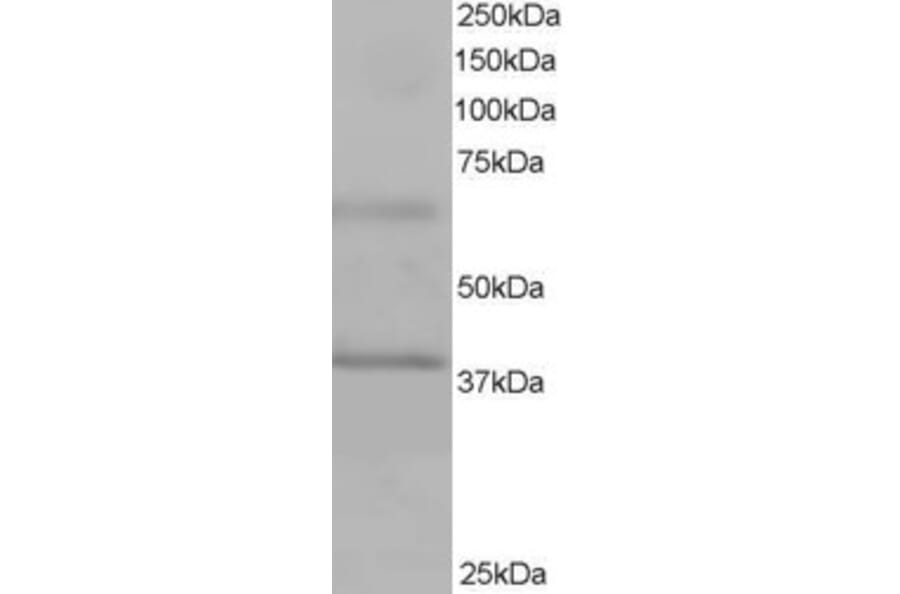 Western Blot - Anti-BPOZ/ABTB1 Antibody (A83452) - Antibodies.com