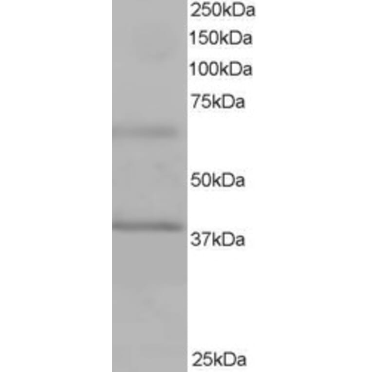Western Blot - Anti-BPOZ/ABTB1 Antibody (A83452) - Antibodies.com
