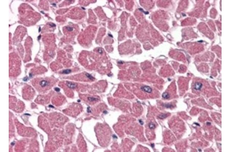 Immunohistochemistry - Anti-BPOZ/ABTB1 Antibody (A83452) - Antibodies.com