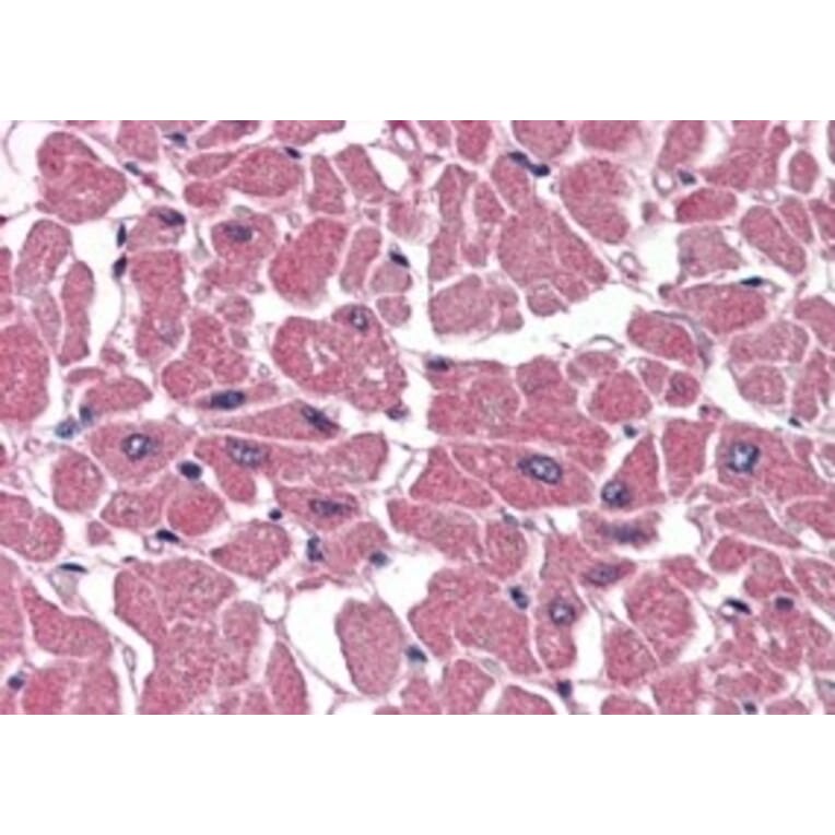 Immunohistochemistry - Anti-BPOZ/ABTB1 Antibody (A83452) - Antibodies.com
