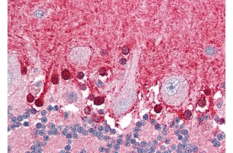 Immunohistochemistry - Anti-BPOZ/ABTB1 Antibody (A83452) - Antibodies.com